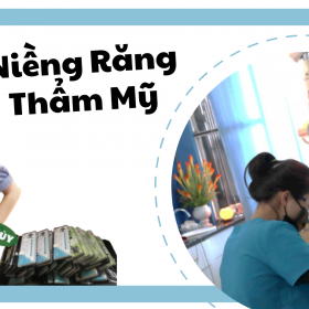 Niềng răng thẩm mỹ