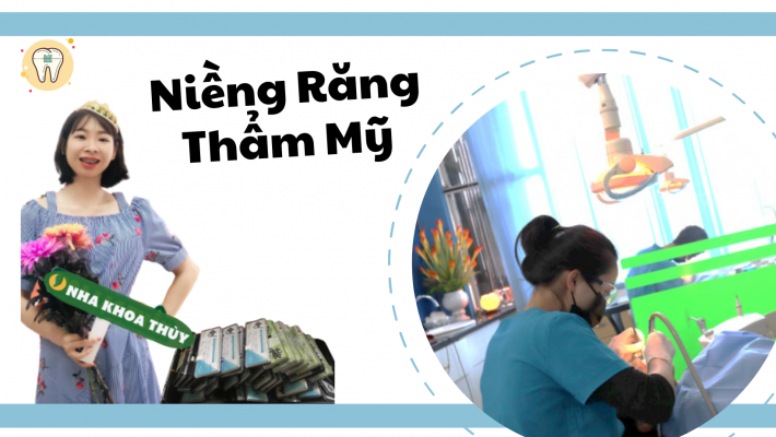 Niềng răng thẩm mỹ
